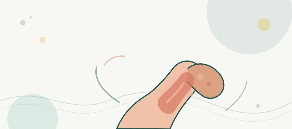 湿疹与皮炎健康主题主题插画